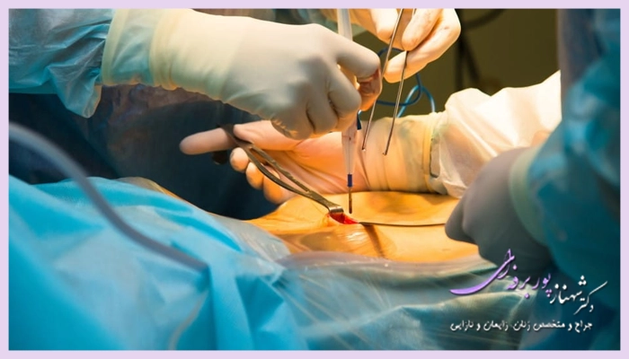 هیستروسکوپی چگونه انجام می شود؟